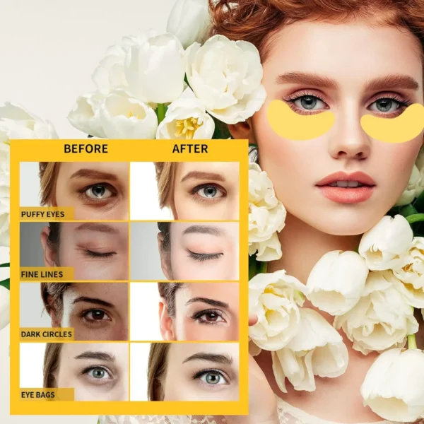 Anti Eye Masks for Swollen Under Eyes Care, 30 Pairs Gold Collagen