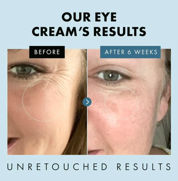 Underneath Eye Lotion for Bags