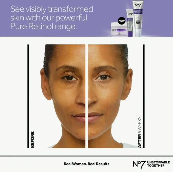 #7 Pure Retinol Under Eye Cream with Collagen Peptides and Shea Fine Line Reduction (0.5 oz)