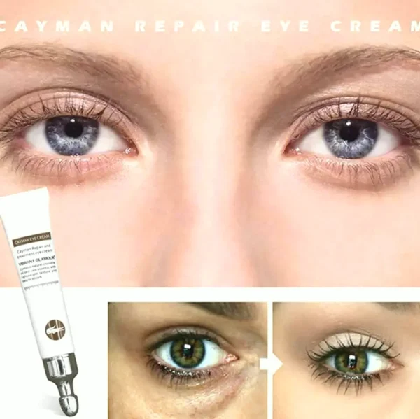 Age-Defying Luxury Under-Eye Cream, Reduces Crows Feet