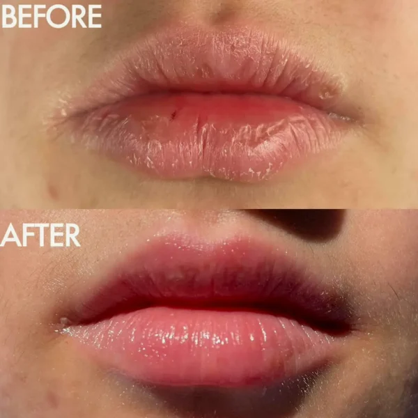 Lano Multi Balm, Watermelon - Hydration
