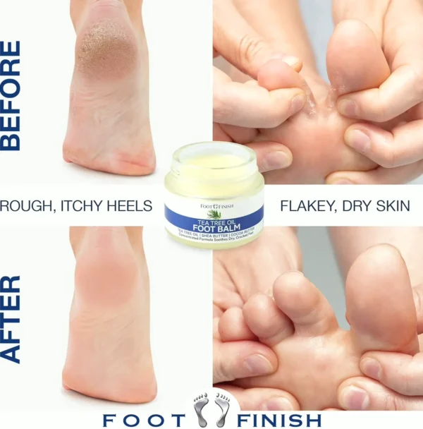 ADMIRE, LORI Tea Tree Balm - Heel Balm for Dry Feet (3.5oz)