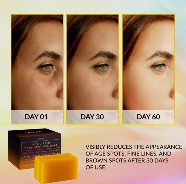 VALITIC Kojic Acid Soap Two Package