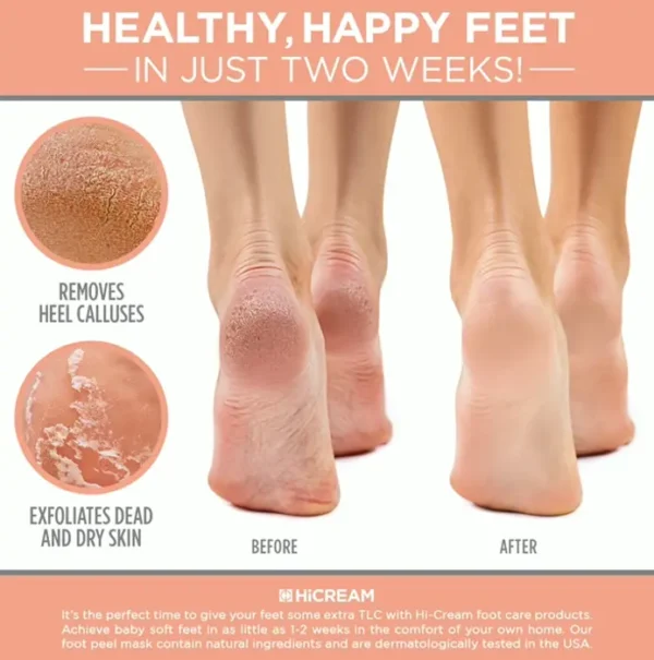 Foot Peel Treatment - Double Pack, Peach Scent